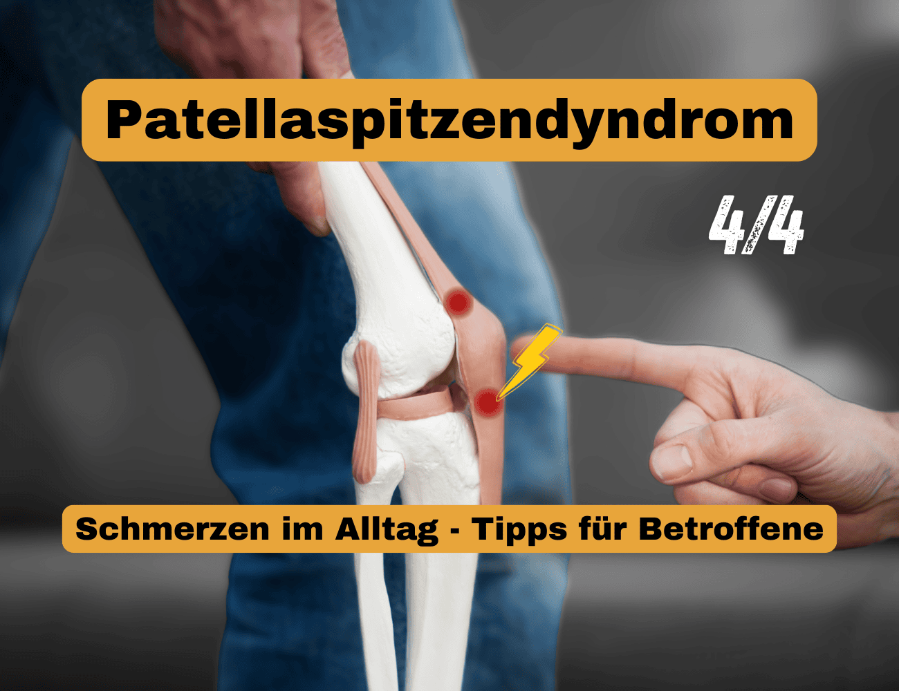 Patellaspitzensyndrom im Alltag - Tipps für Betroffene